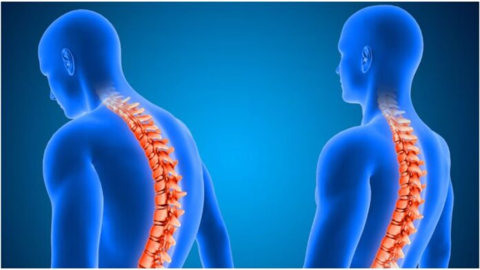 Ways To Improve Poor Posture: शरीर का झुकना बना नई आफत वैज्ञानिकों ने दी डरावनी चेतावनी! जानिए क्या है इससे बचने का उपाय
