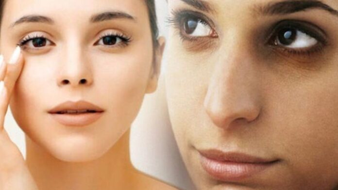 Dark circles: चेहरे की खूबसूरती छीनने वाले काले घेरे कहीं किसी गंभीर बीमारी का इशारा तो नहीं! जानिए क्यों है ये खतरनाक